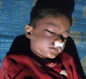 Bhopal Suspicious Death