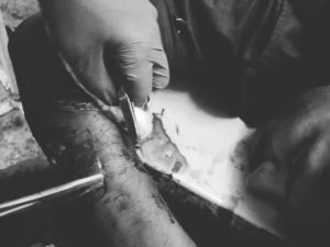 Bhopal Cop Attack News